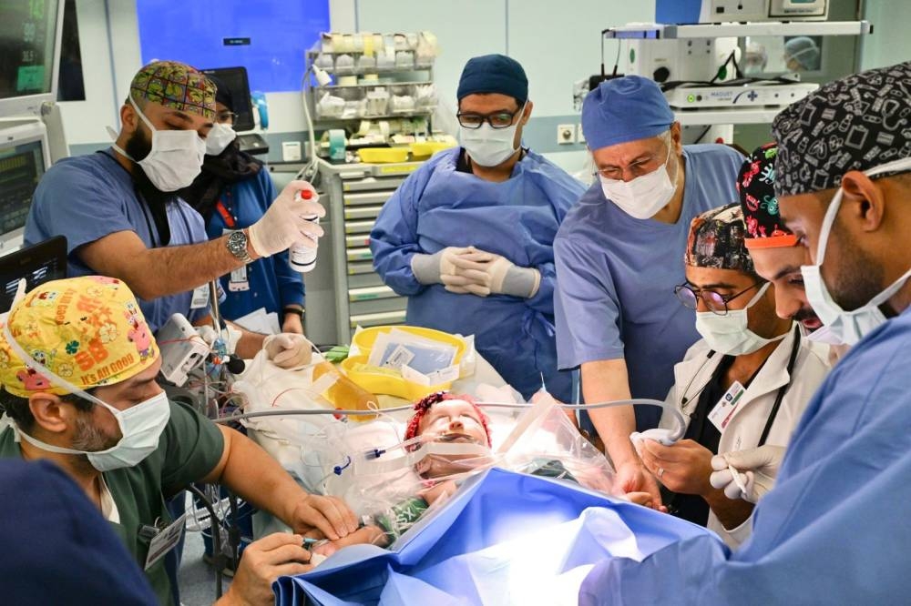 عملية فصل التوأم الملتصق السعودي يارا ولارا تنطلق اليوم بنجاح كبير