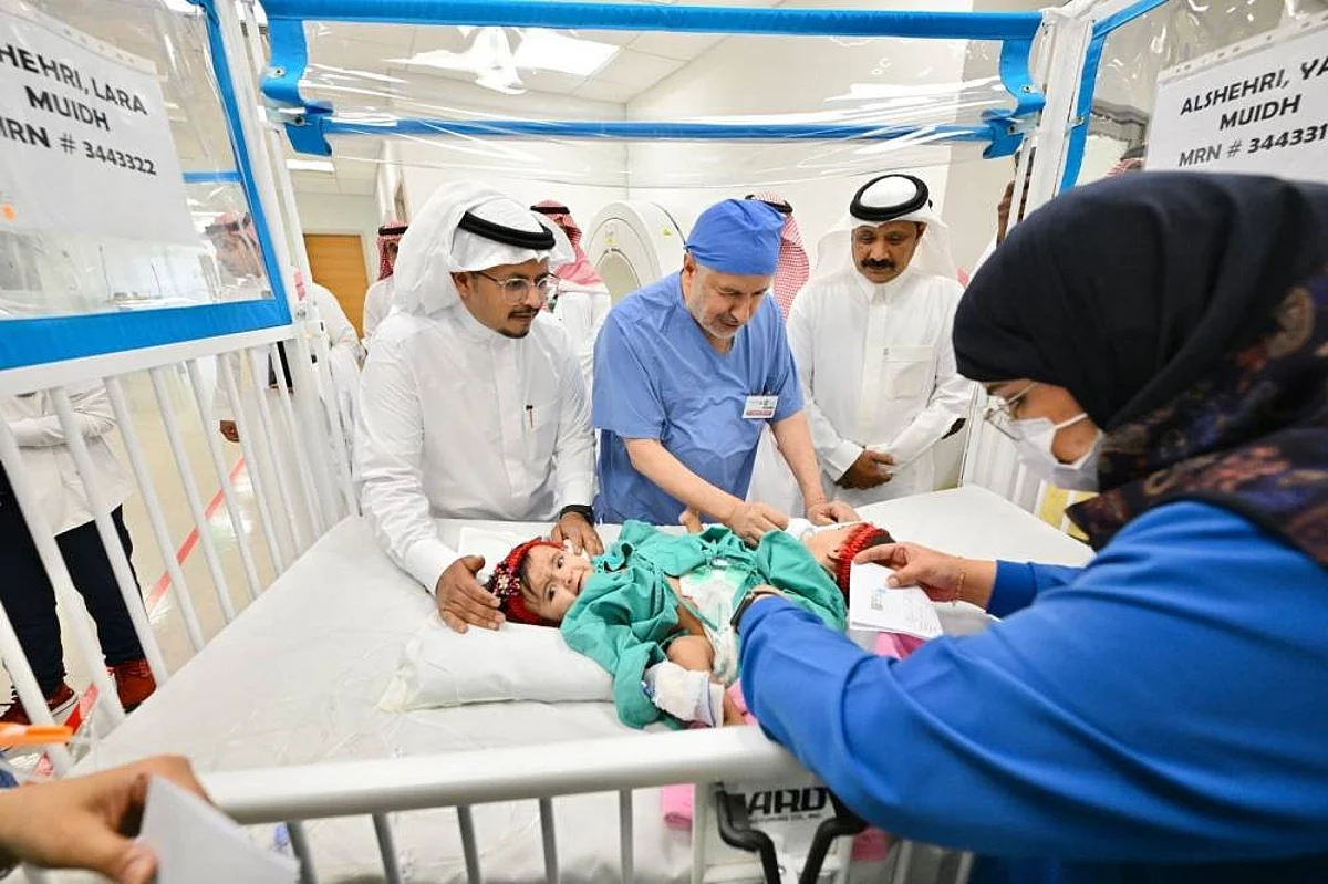 نجاح فصل التوأم السعودي لارا ويارا: الربيعة يعلن الإنجاز الطبي الجديد