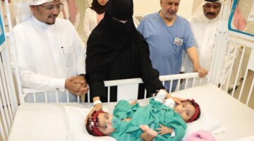 بدء عملية فصل التوأم السيامي السعودي يارا ولارا بالرياض يجذب أنظار العالم