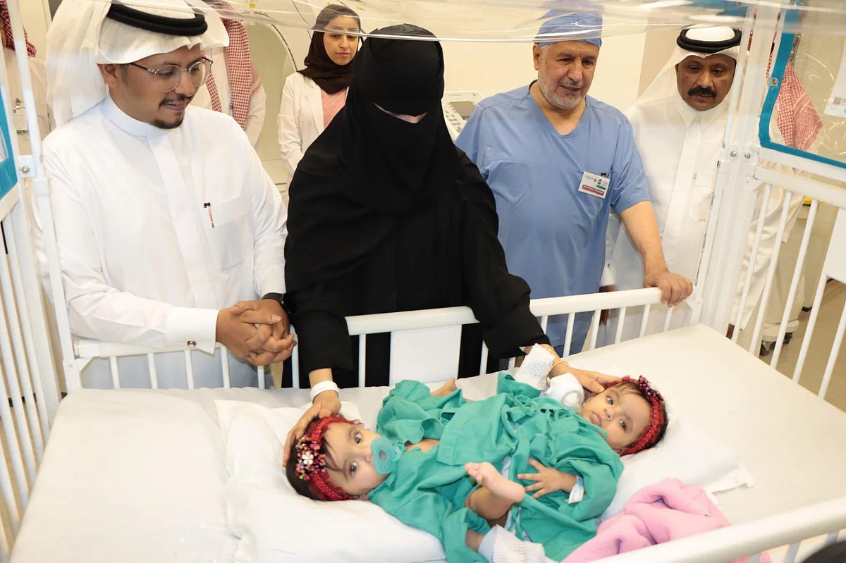 بدء عملية فصل التوأم السيامي السعودي يارا ولارا بالرياض يجذب أنظار العالم