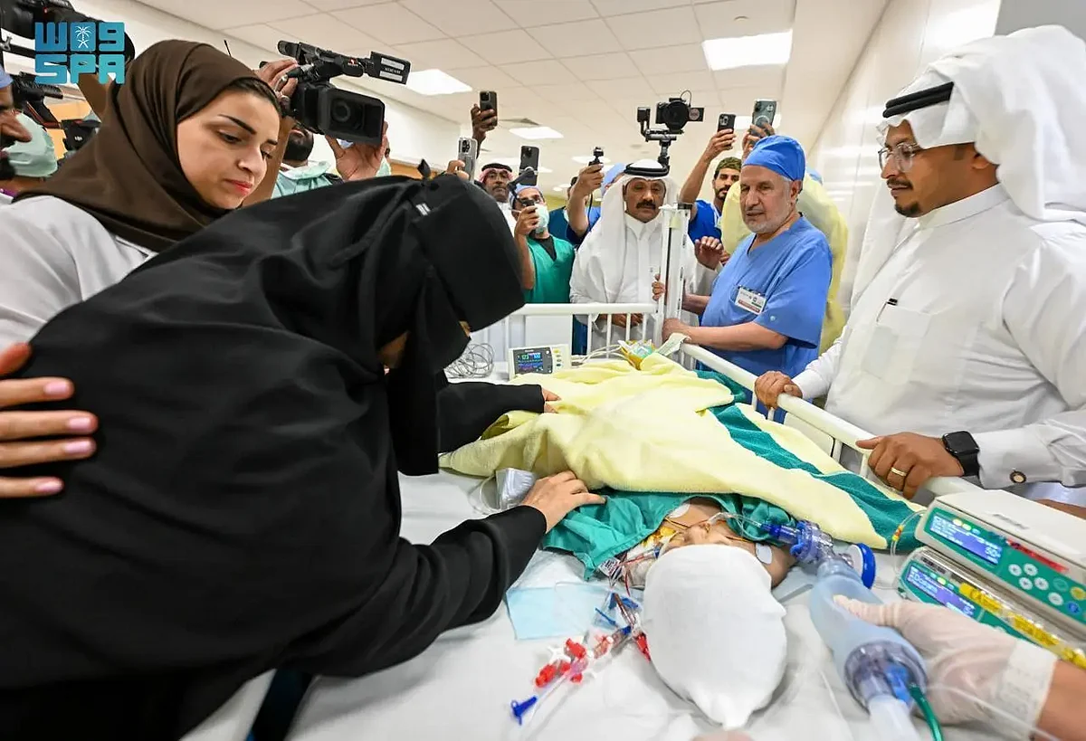 نجاح فصل التوأم السعودي يارا ولارا: الربيعة يعلن إنجاز العملية بمشاركة 38 مختصًا
